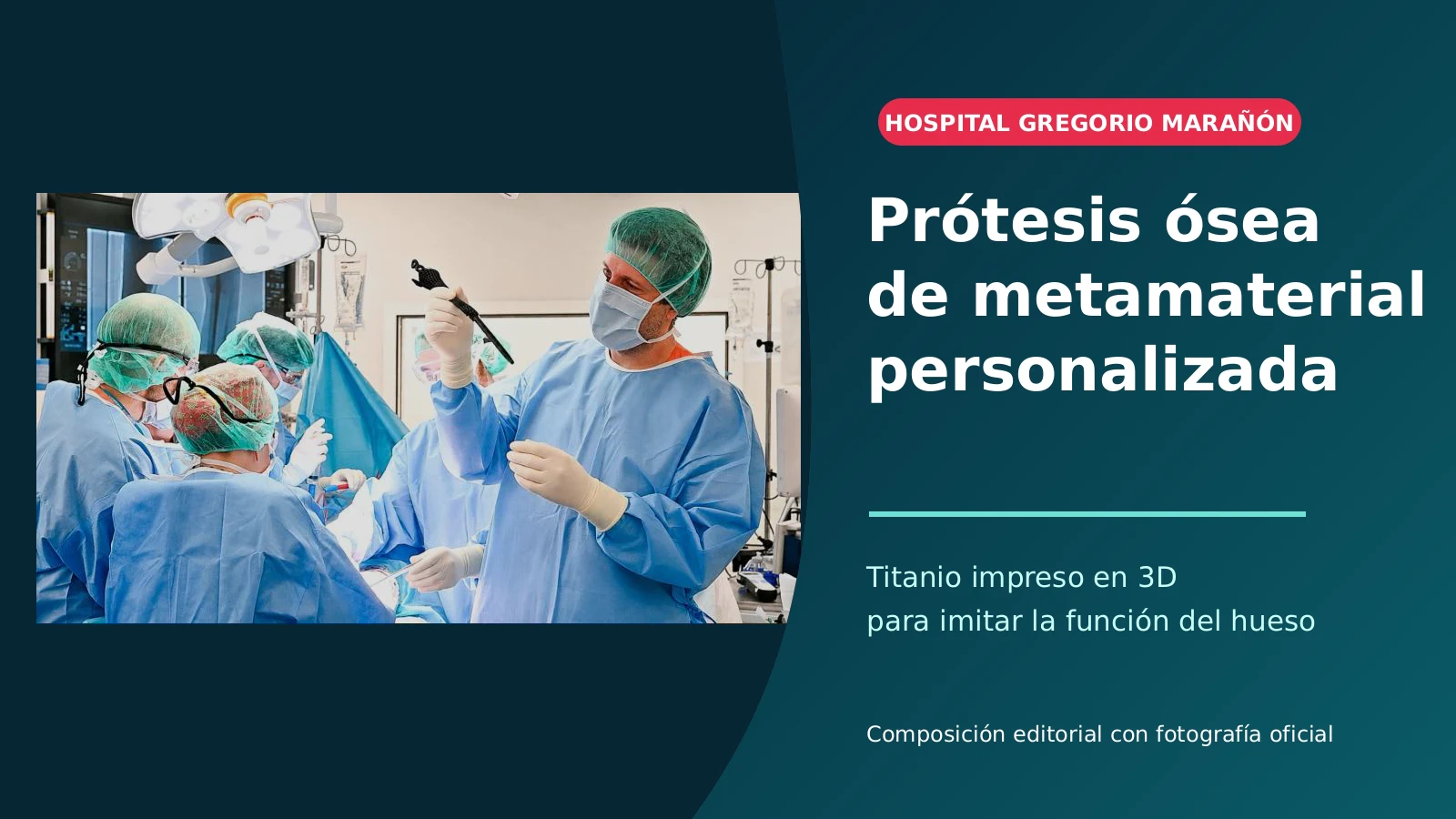 Equipo quirúrgico del Gregorio Marañón con la prótesis ósea de metamaterial